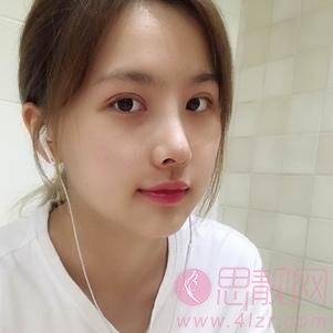 南京华美沈正宇做鼻子怎么样？2020价格表明细一览+隆鼻案例分享