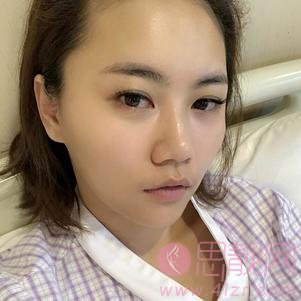 杭州华山连天美整形高俊明颧骨颧弓整形怎么样？附案例分享及2020价格公开