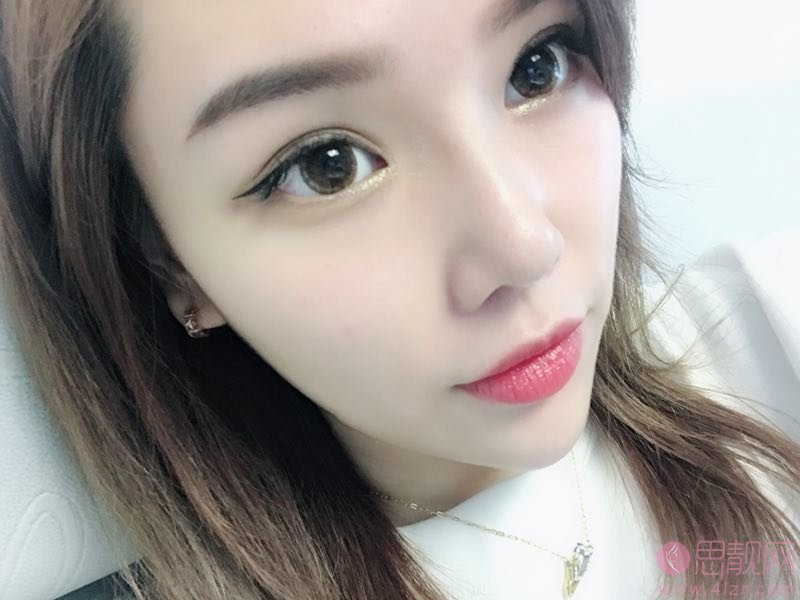 武汉美莱整形医院隆鼻如何？附隆鼻真人案例一览+2020价格表分享