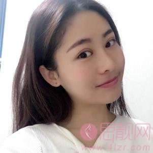 成都美莱黄小林做双眼皮怎么样？附双眼皮真人分享及2020价格表发布