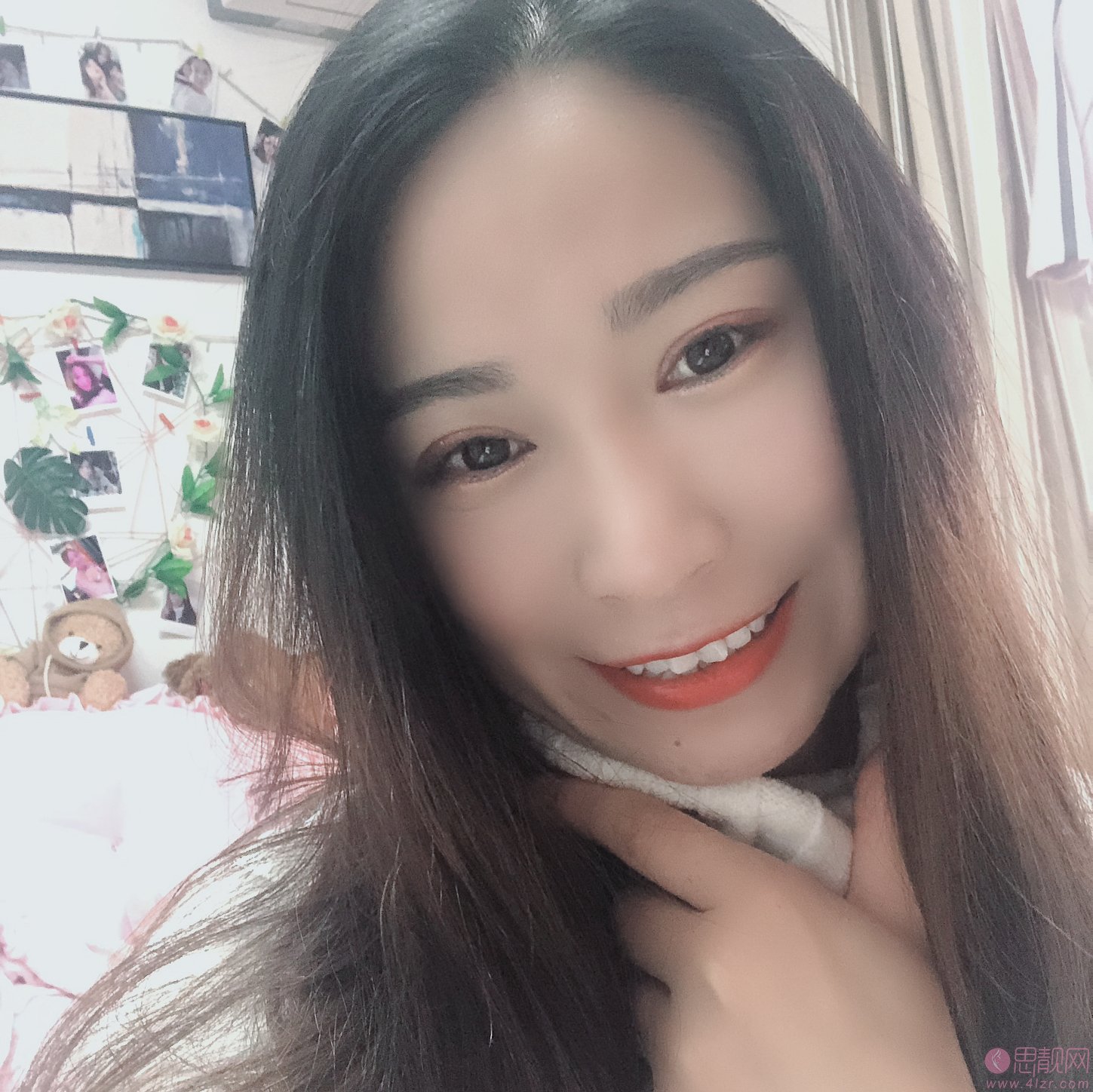 上海卓越口腔美白牙齿如何?附牙齿美白案例真人分享+2020价格表发布