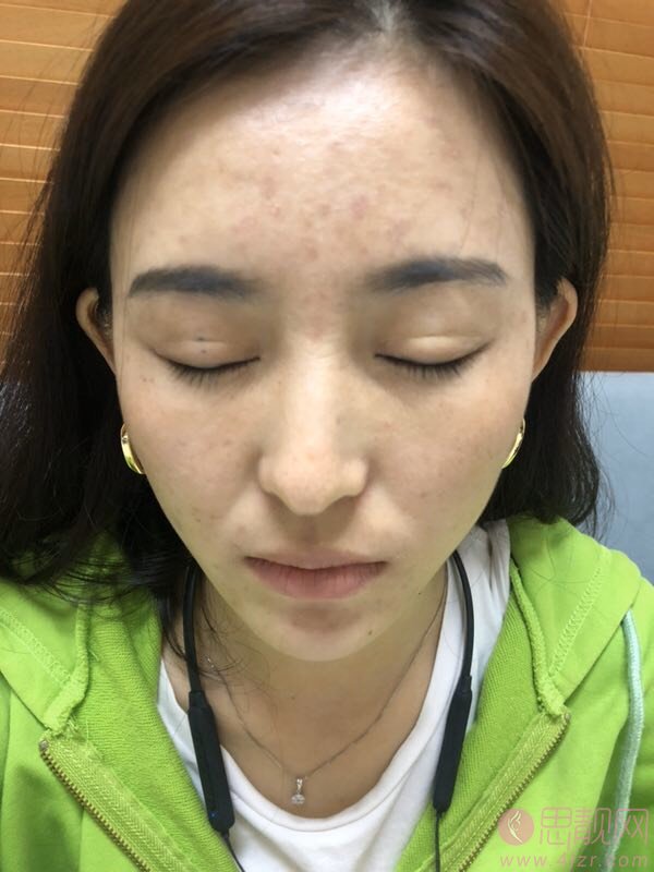 北京彤美刘风卓眼修复贵吗？附价格表及案例一览