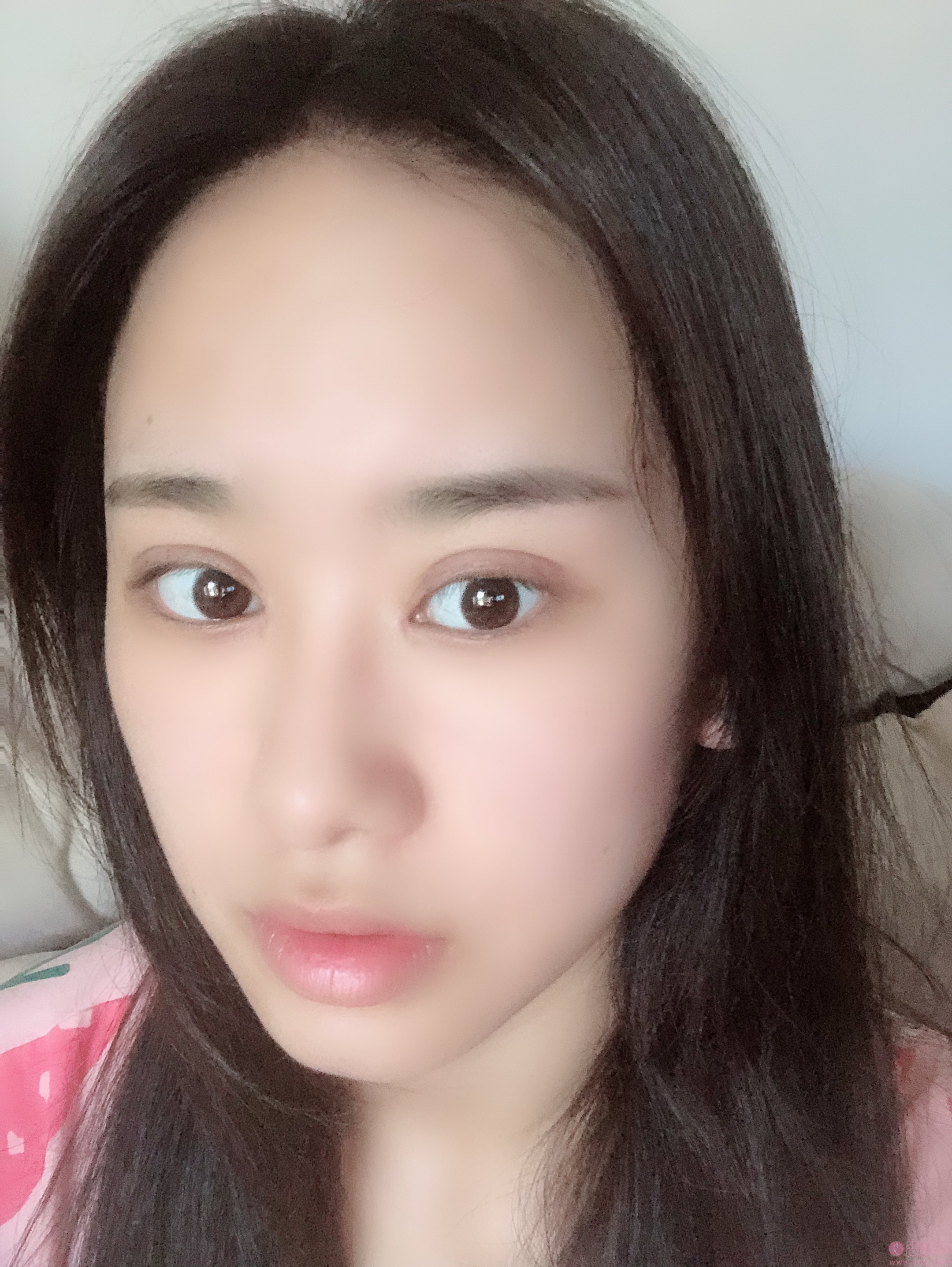 佛山美莱整形张安利做眼部修复怎么样？附眼修复真人案例分享及2020价格表一览