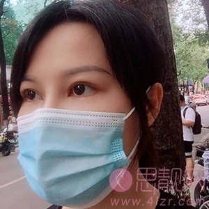 首都医科大学附属北京安贞医院整形美容科李斌斌修复双眼皮怎么样？附修复案例及2020价格表曝光