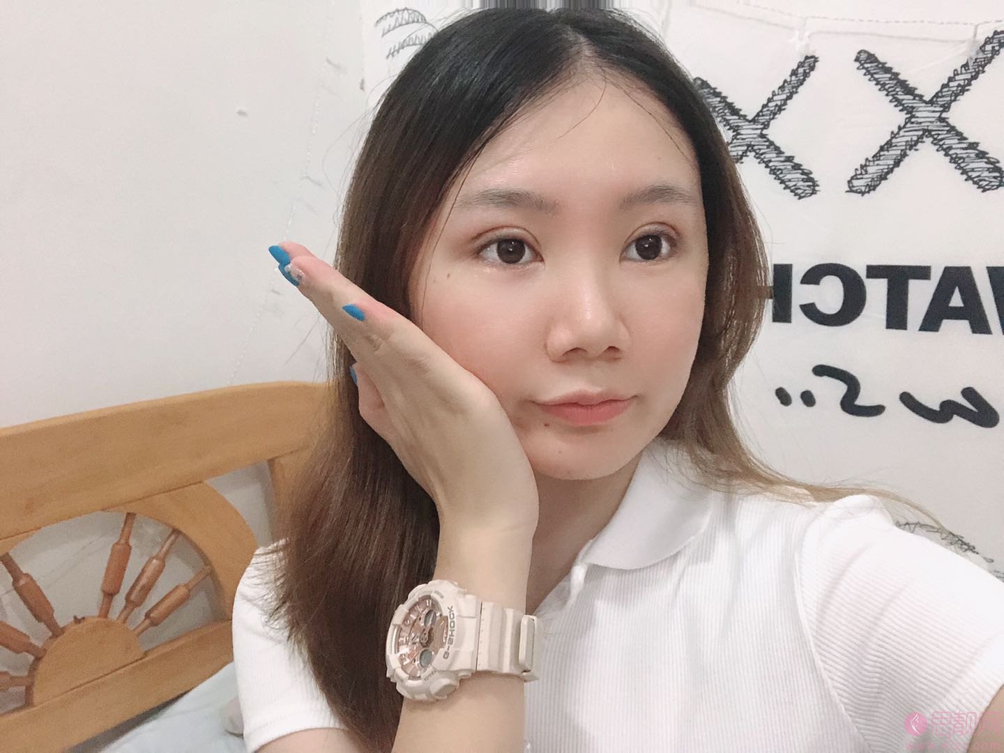 上海德媛医疗美容门诊部怎么样+2021年价格表明细一览+双眼皮真人案例分享