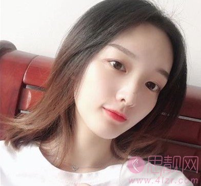 郑州缔莱美杨胜发隆鼻怎么样？附隆鼻真人案例及2021年价格表一览