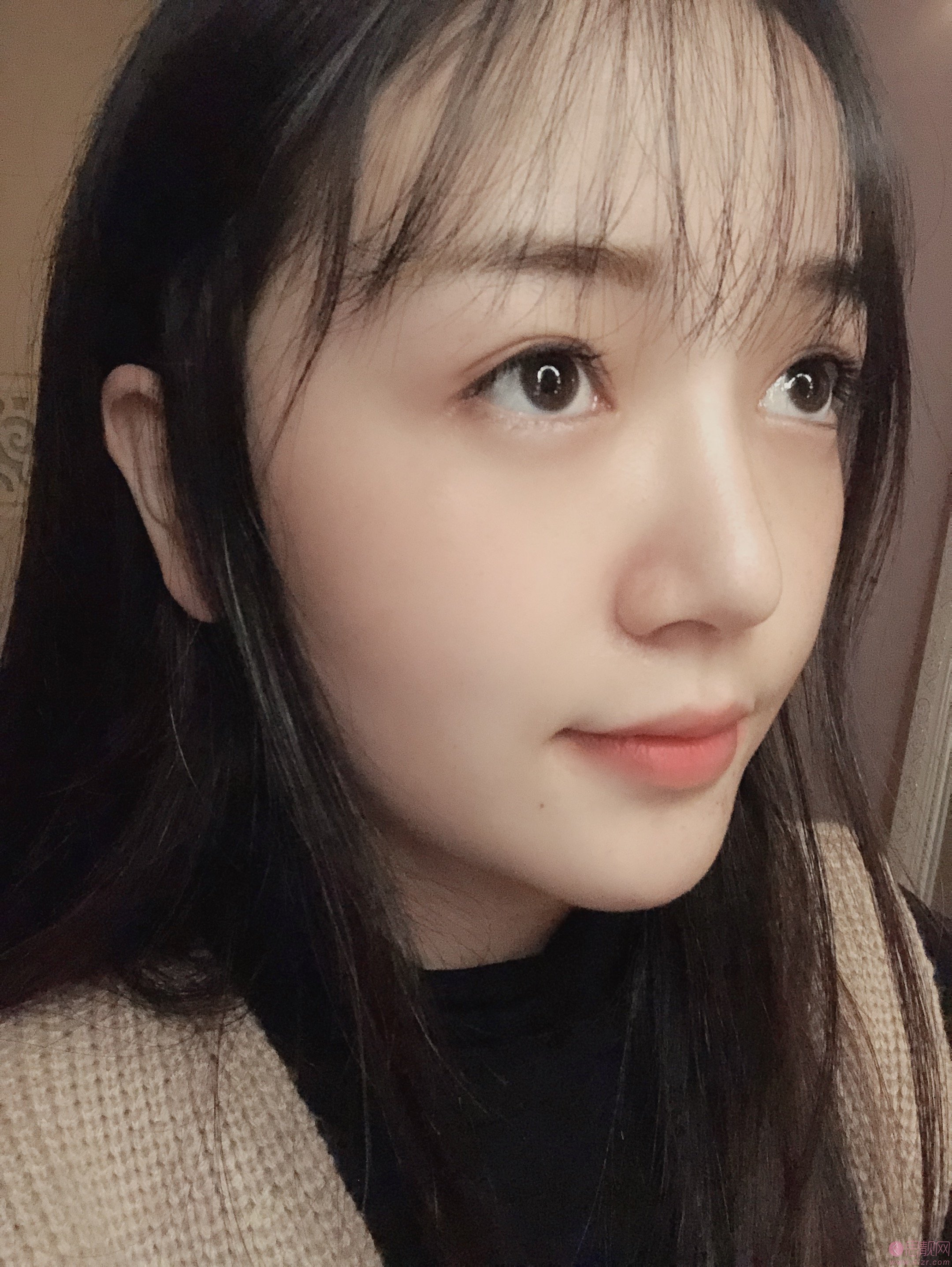 广州美莱医疗美容刘豪隆鼻怎么样？隆鼻案例分享+2021年价格表公开