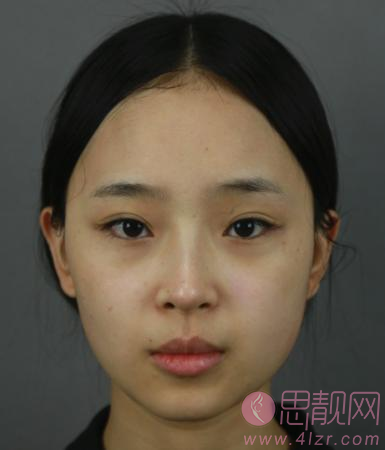 北京泰美丽格医疗美容诊所？2021年价格表公开+埋线提升术后效果对比一览