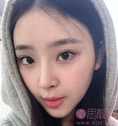 北京泰美丽格医疗美容诊所？2021年价格表公开+埋线提升术后效果对比一览