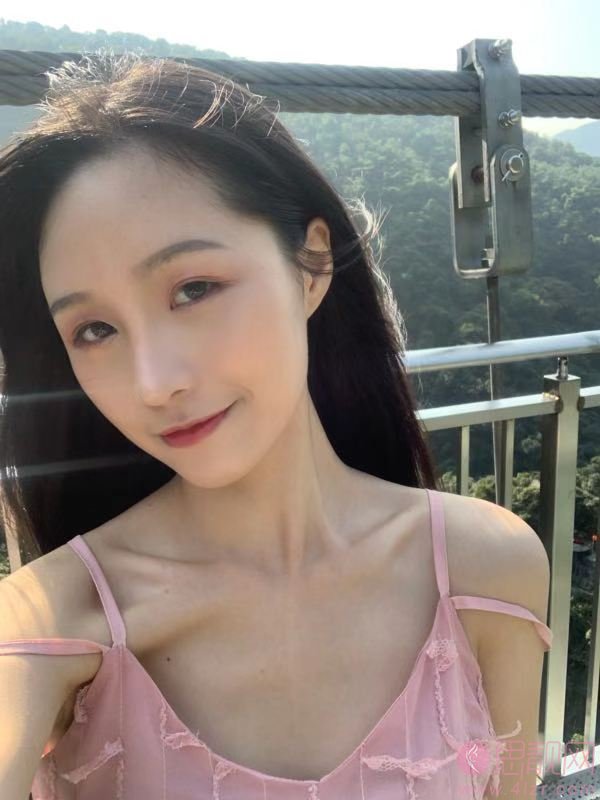 广州美莱罗延平做的鼻子怎么样？附隆鼻真人案例分享及价格表曝光