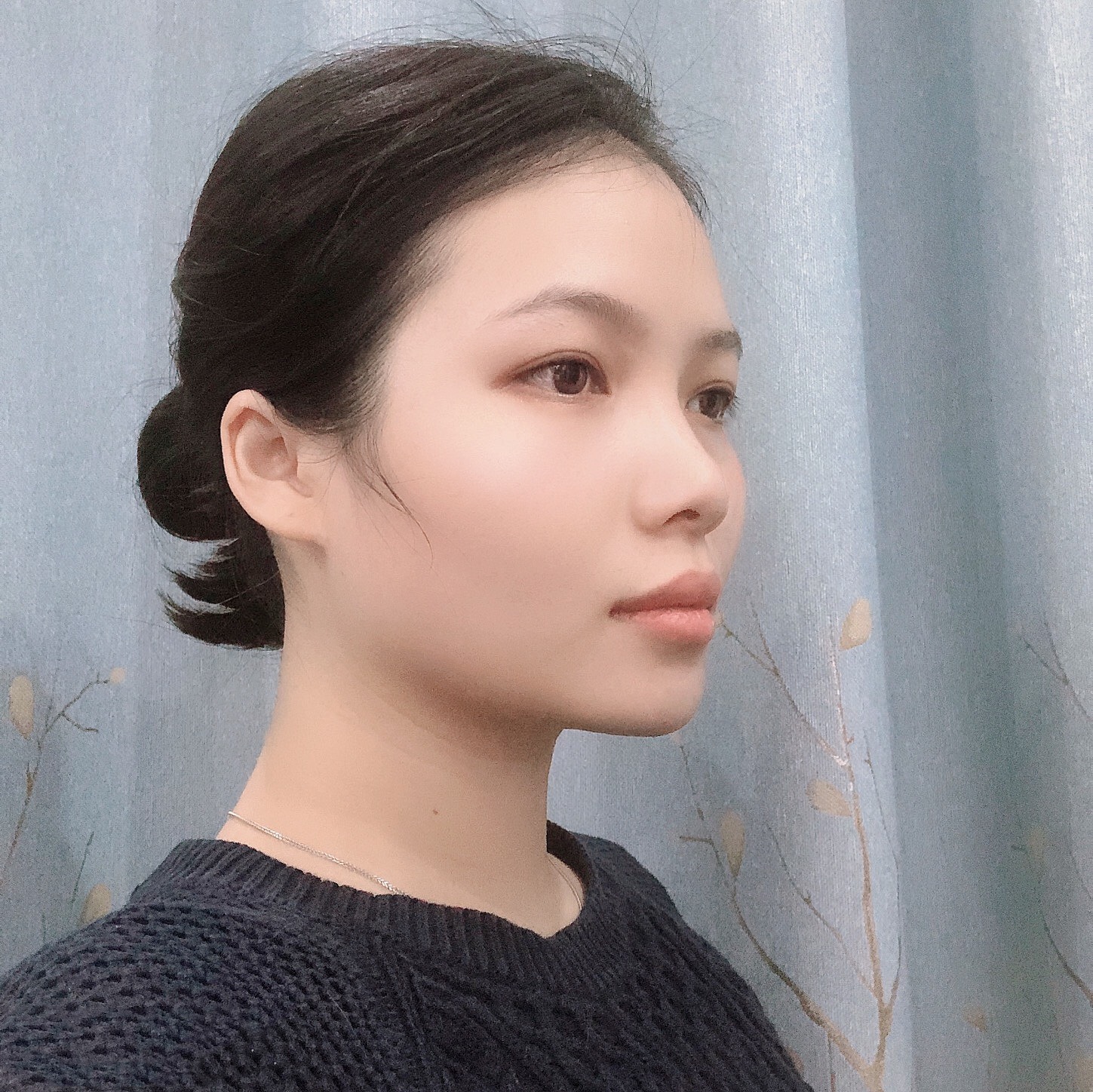 广州美莱医疗美容怎么样？附热玛吉前后效果对比+2021价格表一览