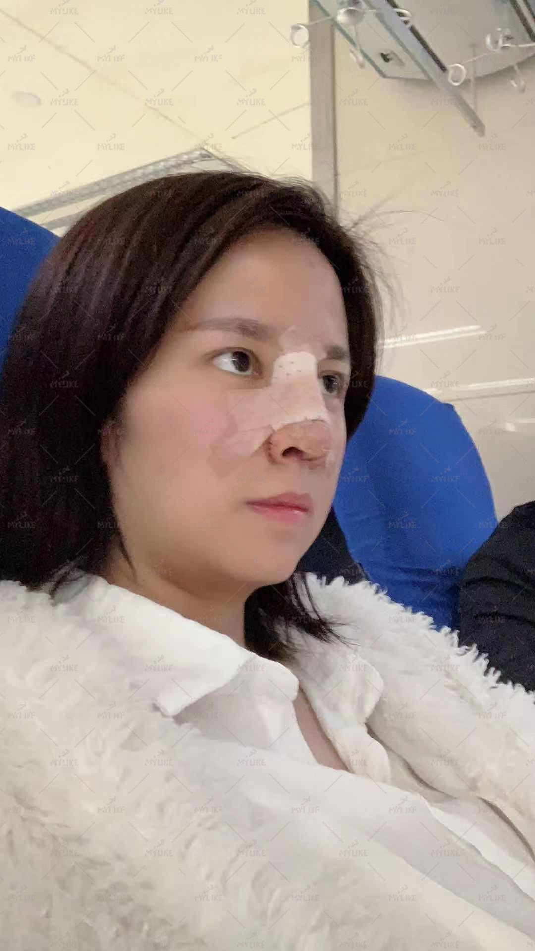 昆明华美美莱余龙做的鼻子怎么样