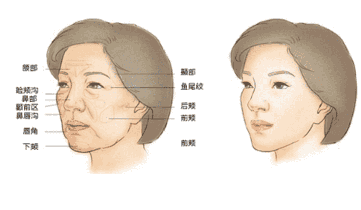 湘雅整形外科怎么样医院实力医生介绍+面部填充案例分享