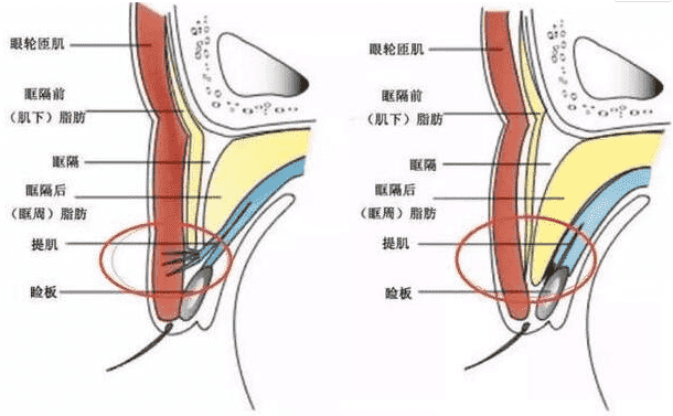 西安医学院第二附属医院双眼皮技术好不好一文带你了解医院实力~